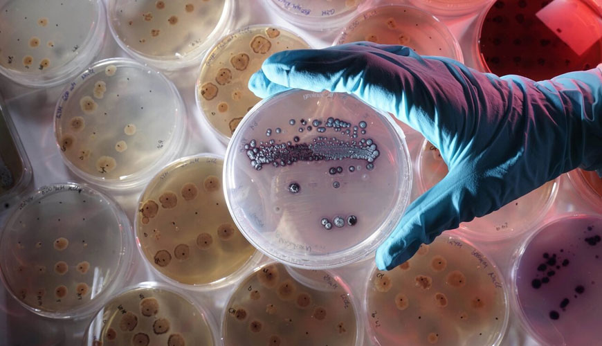 ASTM E1428 評估聚合物固體上或表面上的抗菌劑對鏈黴菌（粉紅點生物）染色性能的測試標準