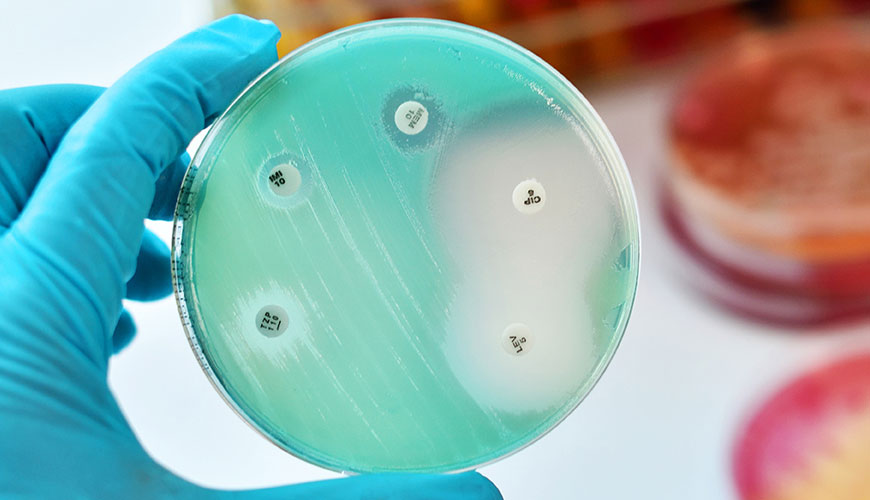 ASTM E2149 szabványos vizsgálati módszer az antimikrobiális szerek antimikrobiális aktivitásának meghatározására dinamikus érintkezési körülmények között