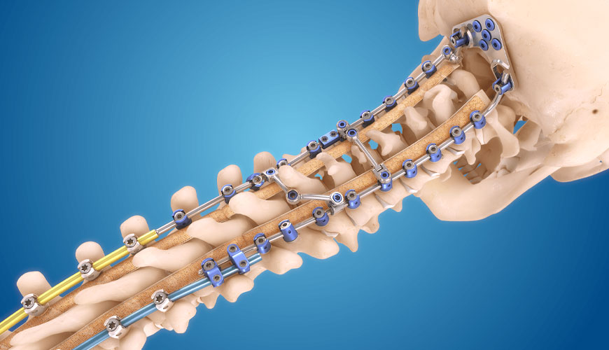 ASTM F2193 Standardna preskusna metoda za komponente, ki se uporabljajo pri kirurški fiksaciji skeletnega sistema hrbtenice