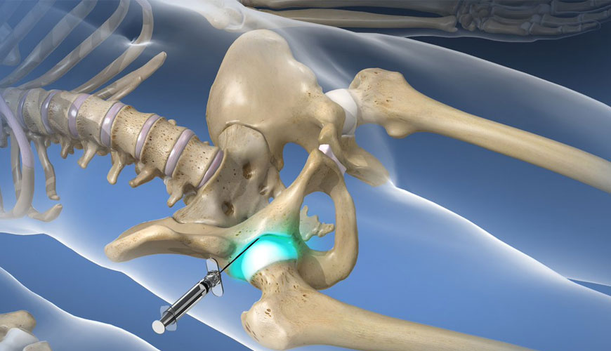 ASTM F2582-14 Standardna preskusna metoda za udarce v acetabularne proteze