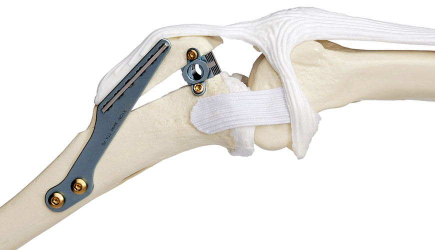 ASTM F2722 評估移動軸承膝關節脛骨底板旋轉停止的標準實踐