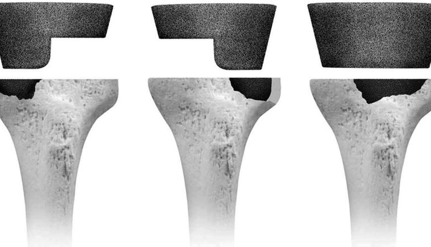 ASTM F3140-17 Standardna preskusna metoda za preskušanje ciklične utrujenosti kovinskih komponent tibialnega pladnja za zamenjave enokondilnega kolenskega sklepa