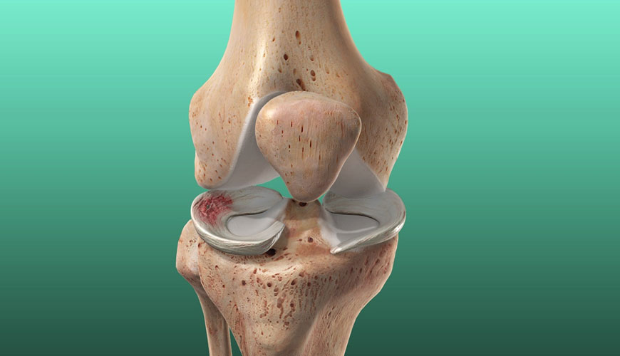 ASTM F3223 Test za kirurško popravilo ali rekonstrukcijo meniskusa kolena