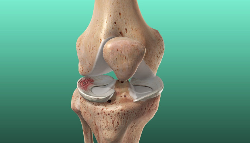 ASTM F3223 Diz Menisküs Cerrahi Onarımı veya Rekonstrüksiyonu için Test