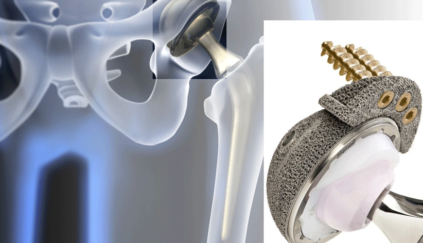 ASTM F746-04 szabványos vizsgálati módszer fémes sebészeti implantátumanyagok lyukas vagy repedéskorróziójához