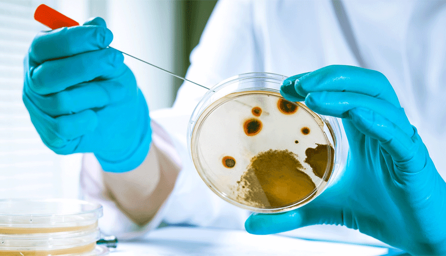 ASTM G21 Test Standard for Determining Fungal Resistance of Synthetic Polymeric Materials