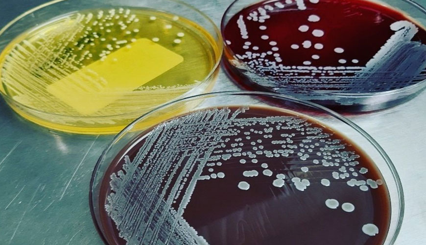 ATCC 6538 Staphylococcus Aureus Tests