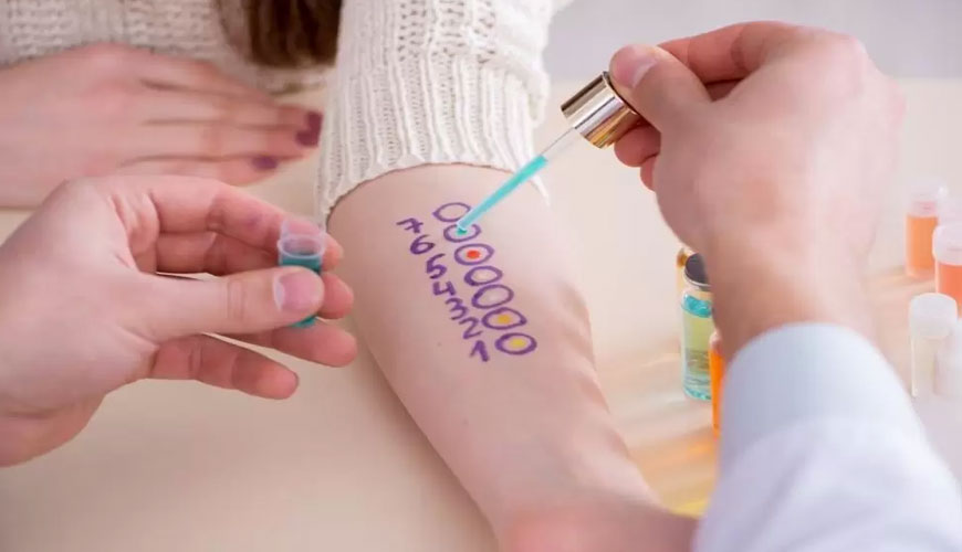 การทดสอบความไวของผิวหนัง