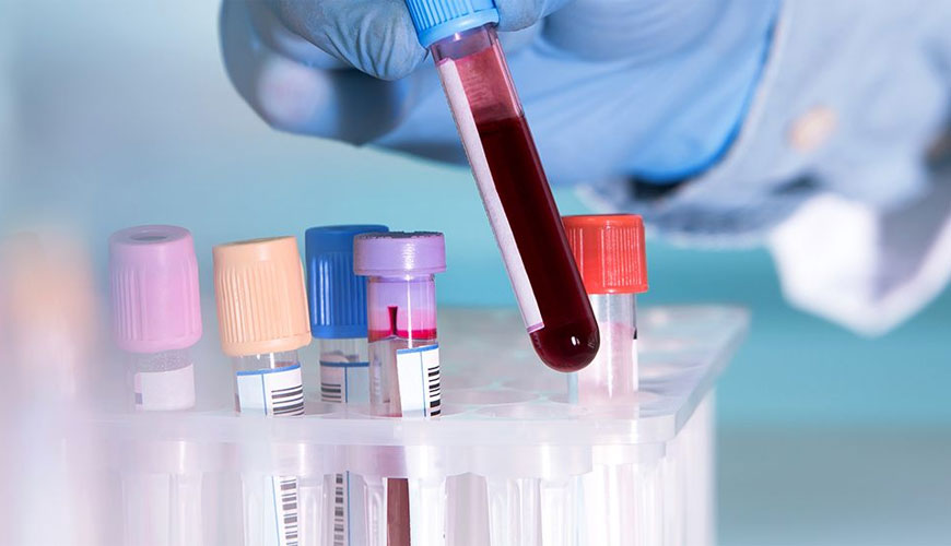Referensi CLSI H15-A3 dan Prosedur Terpilih untuk Penentuan Kuantitatif Hemoglobin dalam Darah - Standar yang Disetujui