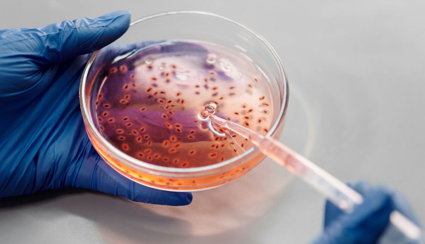 CLSI MM06-A2 Enfeksiyon Hastalıkları için Kantitatif Moleküler Yöntemler - Onaylı Kılavuz