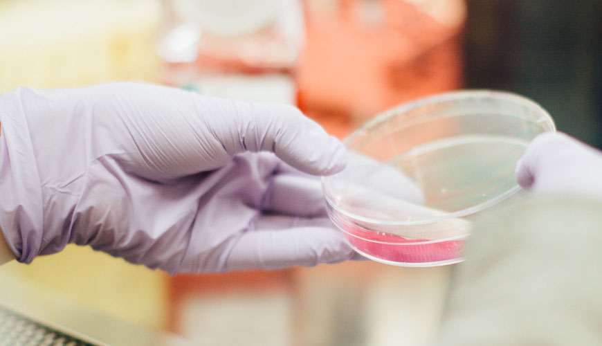 EN 14210 Yüzey Aktif Maddeler - Yüzey Aktif Maddelerin Çözeltilerinin Arayüzey Geriliminin Etriye veya Halka Yöntemiyle Belirlenmesi İçin Standart Test