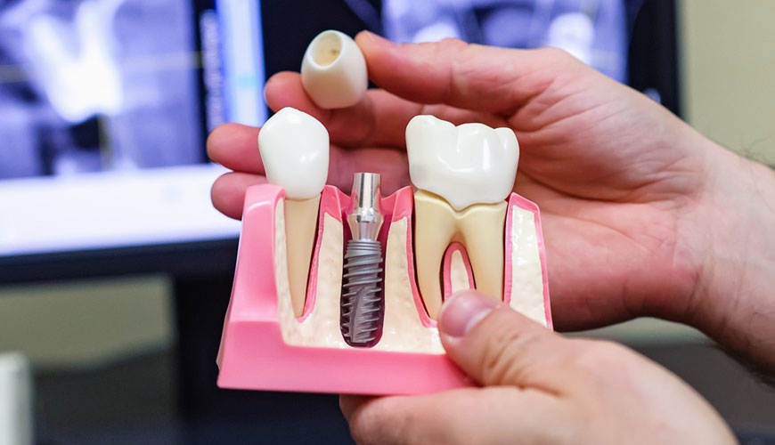 Prueba EN ISO 10451 para sistemas de implantes dentales