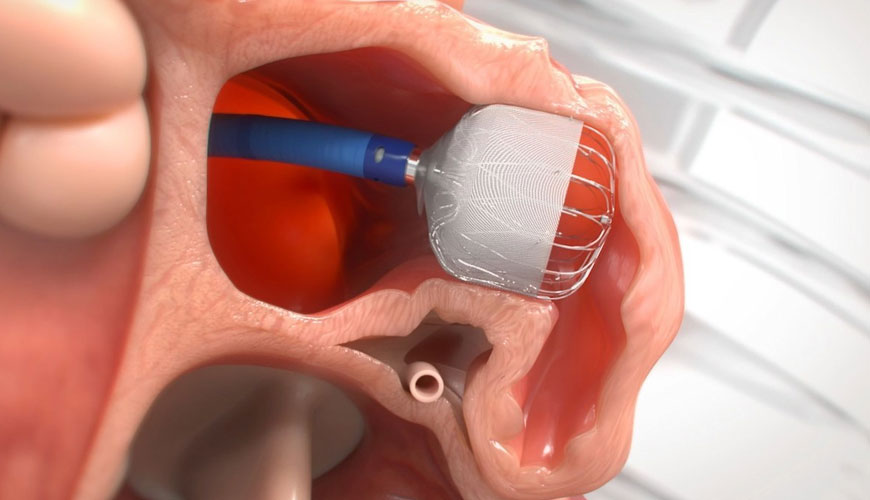 EN ISO 12417-1 Kardiyovasküler İmplantlar ve Ekstrakorporeal Sistemler, Bölüm 1: Genel Gereksinimler Test Standardı