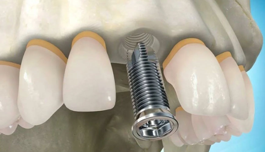 EN ISO 16498 Dentistry, Standard Test for Minimum Dental Implant Dataset for Clinical Use