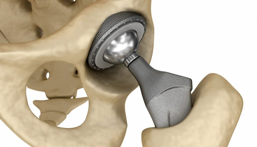 EN ISO 21534 Inactive Surgical Implants, Joint Replacement Implants, Special Requirements