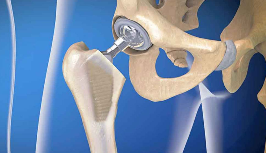 EN ISO 21535 Requisitos especiales para implantes quirúrgicos inactivos, implantes de reemplazo de articulaciones, implantes de reemplazo de articulaciones de cadera
