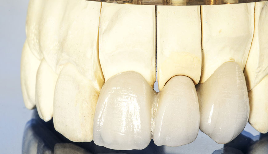 Test de compatibilité EN ISO 9693 pour les systèmes dentaires, métal-céramique et céramique-céramique
