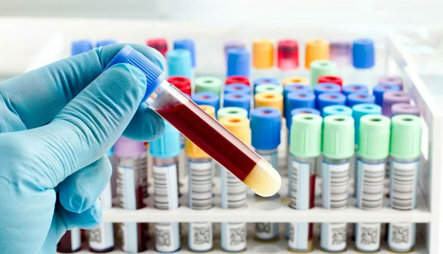 Análisis de Grayanotoxina Análisis de Grayanotoxina