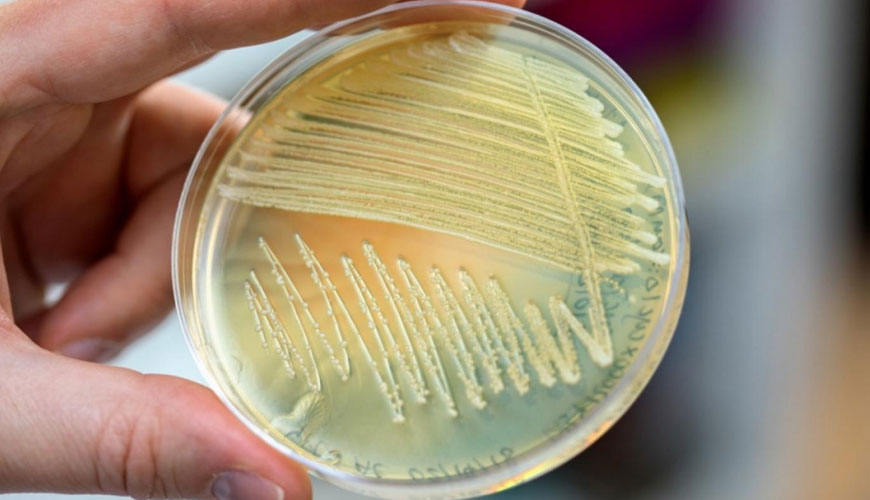 ISO 11290-1 Mikrobiologija prehranjevalne verige, standardni test za odkrivanje in štetje Listeria Monocytogenes in Listeria Spp.
