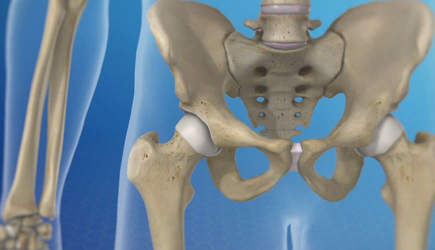 ISO 14242-2 Implantati za kirurgijo – Obraba totalnih protez kolčnega sklepa – Merilne metode
