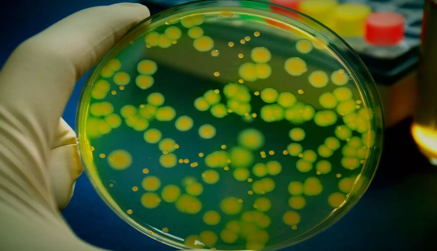 ISO 16000-20 Aire interior - Parte 20: Detección y recuento de mohos - Método de prueba estándar para determinar el recuento total de esporas ISO 16000-20 Aire interior - Parte 20: Detección y recuento de mohos - Método de prueba estándar para determinar el recuento total de esporas