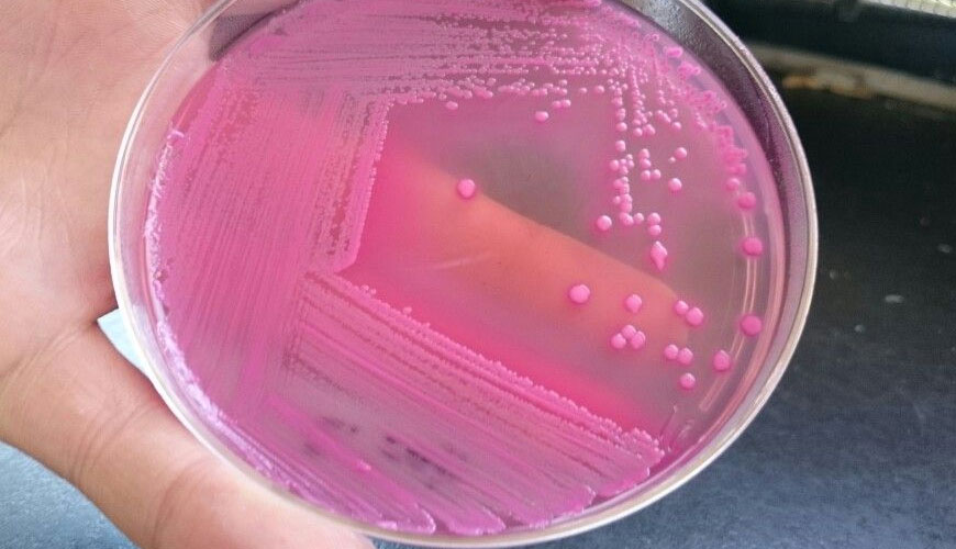 Estándar de prueba de método horizontal ISO 16649-2 para contar Escherichia coli positiva con beta-glucuronidasa Estándar de prueba de método horizontal ISO 16649-2 para contar Escherichia coli positiva con beta-glucuronidasa