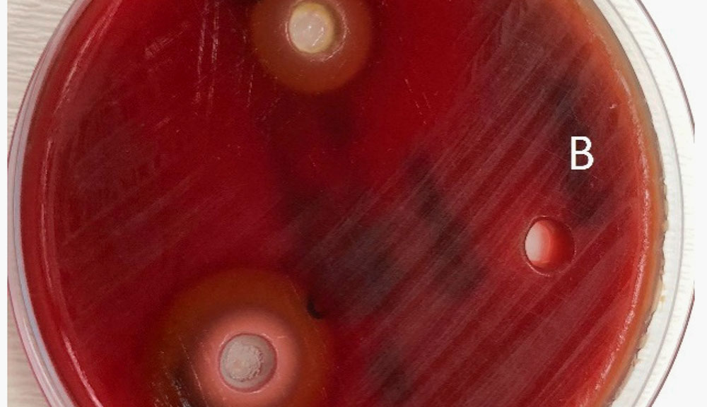 Tissus textiles ISO 20645 - Détermination de l'activité antibactérienne - Essai sur plaque de diffusion d'agar