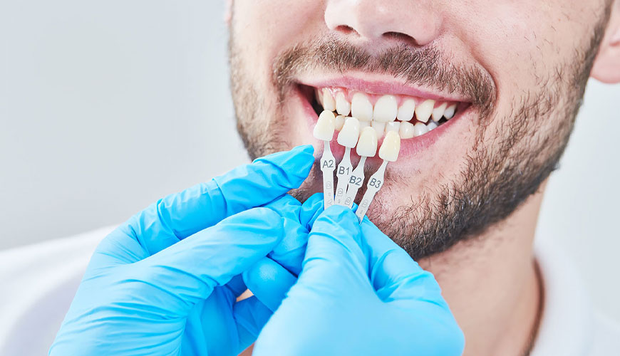 Estándar de prueba de odontología ISO 22112 para dientes artificiales para dentaduras postizas