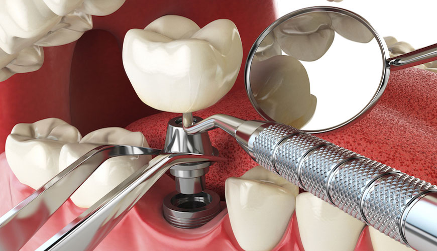 ISO 22674 Dentistry - Test Standard for Metallic Materials for Fixed and Removable Restorations and Appliances