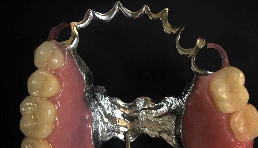 ISO 22674 Dentistry - Metallic Materials for Fixed and Removable Restorations and Appliances