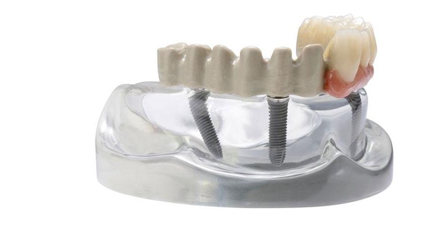 ISO 22794 牙科 - 口腔頜面外科骨填充和增強的可植入材料 - 技術文件內容的測試標準