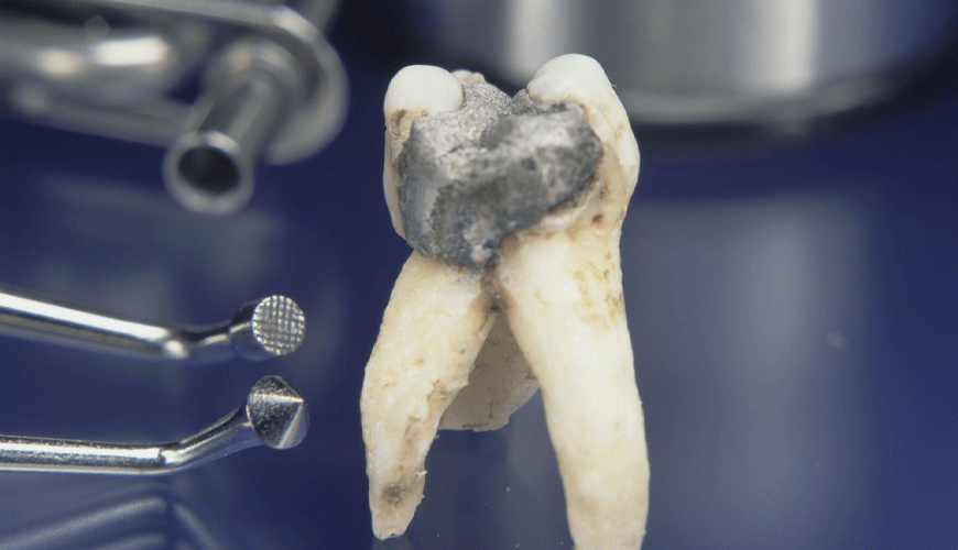 ISO 24234 Zobozdravstvo – Testni standard za zobni amalgam