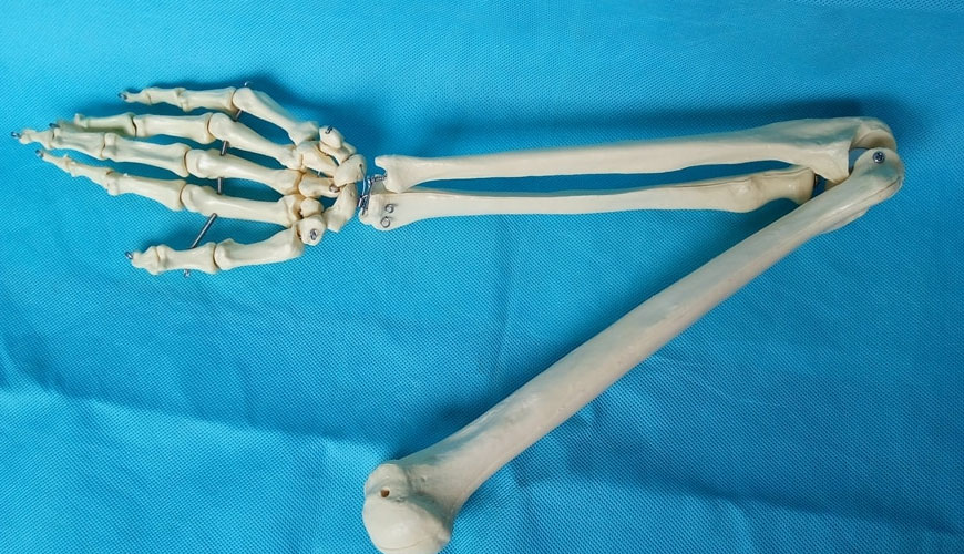 ISO 5838-1 Vsadki za kirurgijo, kovinski skeletni zatiči in žice, 1. del: Splošne zahteve Testni standard