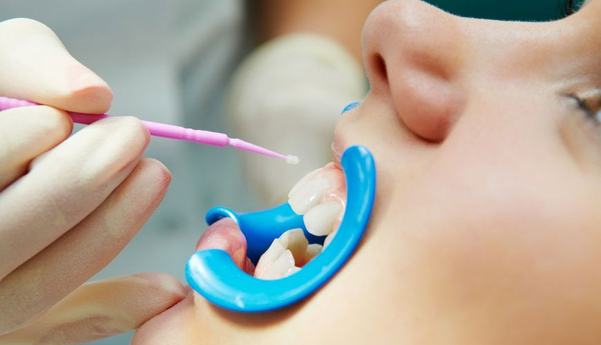 ISO 6874 Zobozdravstvo – Testni standard za tesnilke jam in fisur na osnovi polimera