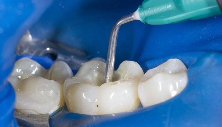 Preskusni standard ISO 6876 za tesnila za zobne koreninske kanale