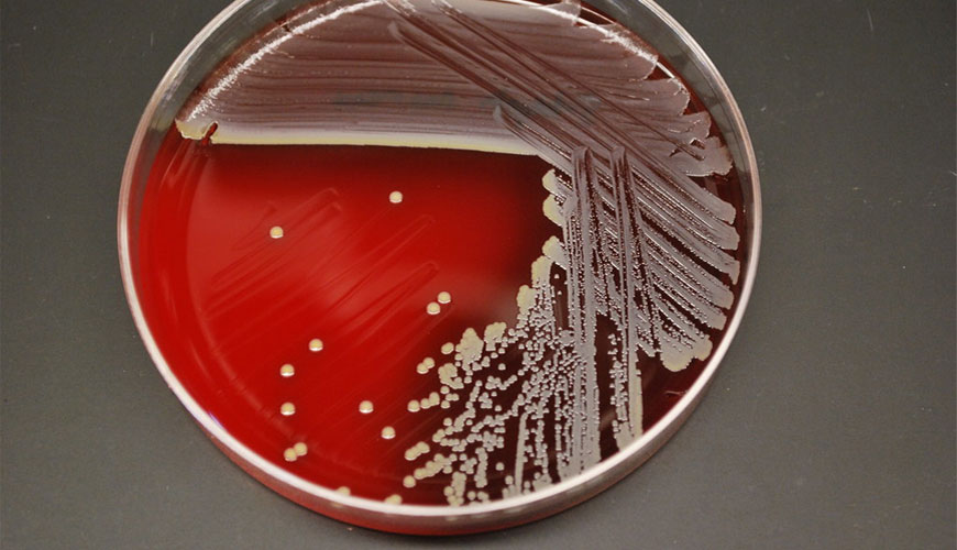ISO 6888-1 Phương pháp ngang để định lượng tụ cầu dương tính đông máu (Staphylococcus Aureus và các loài khác) - Phần 1 - Kỹ thuật sử dụng môi trường thạch Baird-Parker