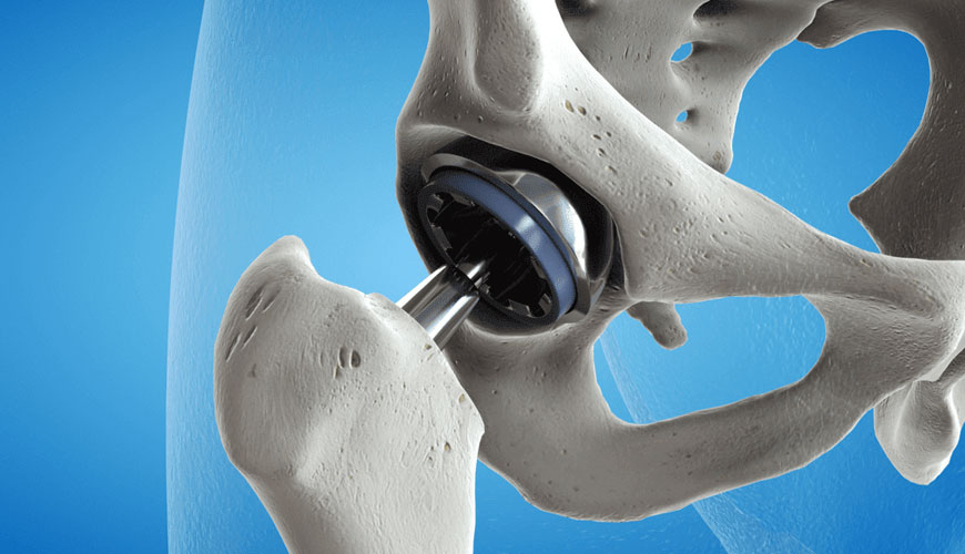 ISO 7206-2 Kirurški vsadki, delne in popolne proteze kolčnega sklepa, 2. del: Standardni test za artikulacijske površine iz kovinskih, keramičnih in plastičnih materialov