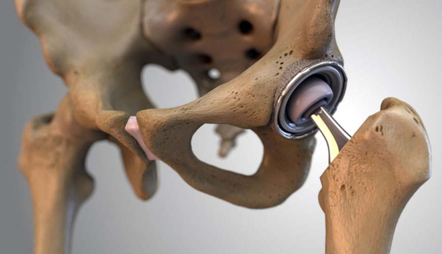 Standardni test ISO 7206-4 za kirurške vsadke, delne in totalne proteze kolčnega sklepa