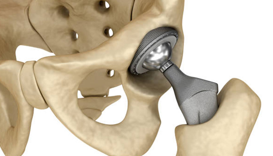 ISO 7206-8 Implantes para cirugía, prótesis parciales y totales de la articulación de la cadera, Parte 8: Prueba estándar para componentes femorales truncados con aplicación de torsión