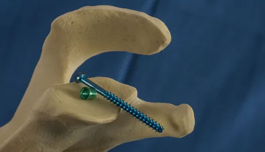 ISO 9585 標準測試方法測定外科植入物的彎曲強度和剛度，骨板