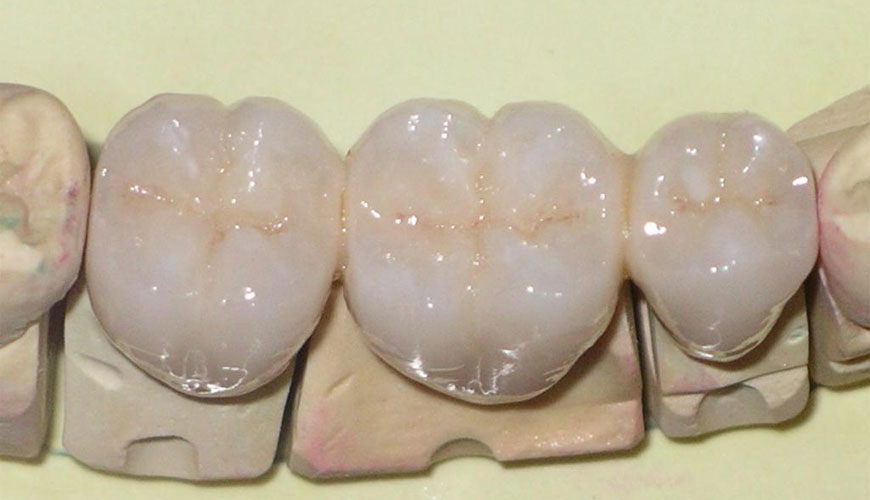 ISO 9693-1 Zobozdravstvo — Preskus združljivosti — Preskusni standard za kovinsko-keramične sisteme
