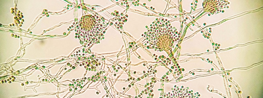 Mantar Direnci Testi