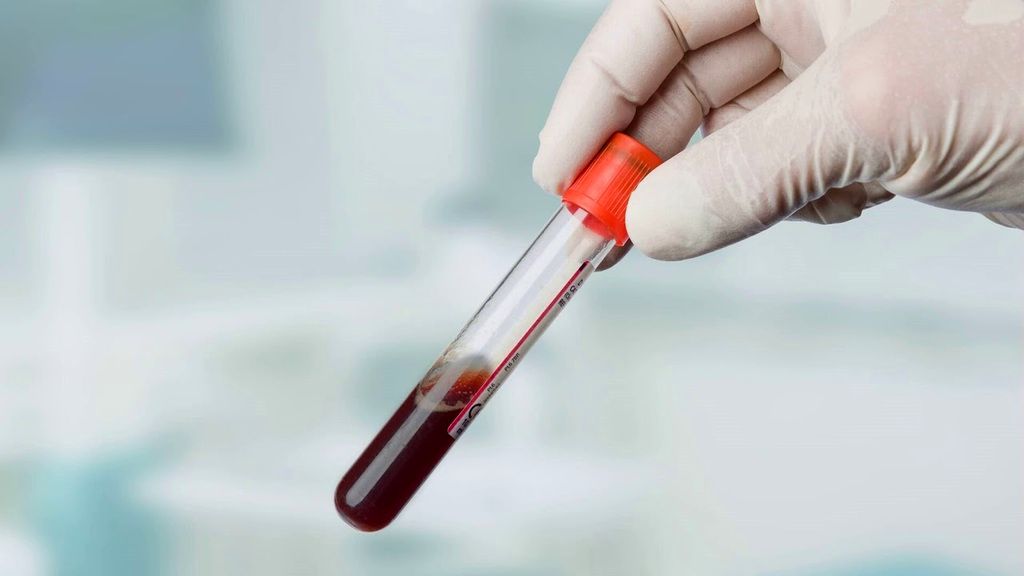 Preskusi taljenih tkanin - sintetični krvni test