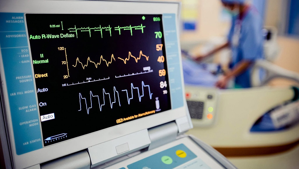 TS EN 60601-2-27 Thiết bị y tế điện - Phần 2-27: Các tính năng cụ thể cho an toàn cơ bản và hiệu suất cần thiết của thiết bị theo dõi điện tim
