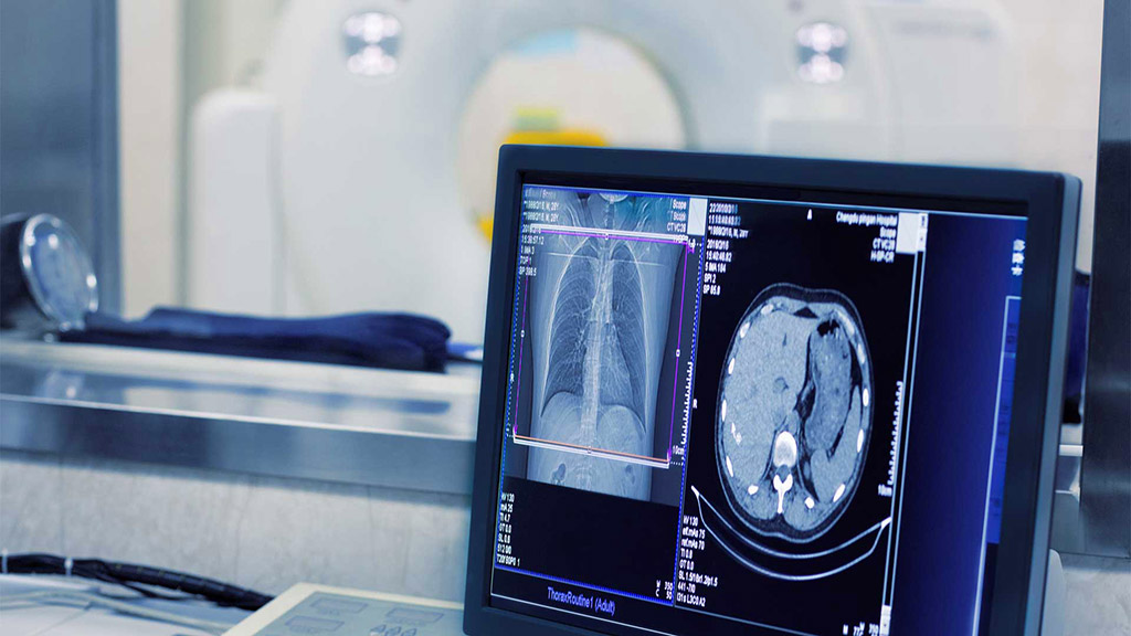 TS EN 60601-2-44 Električna medicinska oprema - Del 2-44: Posebne značilnosti osnovne varnosti in zahtevane lastnosti rentgenske opreme za računalniško tomografijo