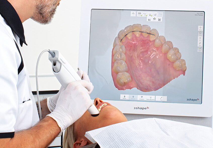 TS EN 60601-2-65 Električni medicinski pripomočki - 2-65. Del: Posebna pravila za osnovno varnost in zahtevano delovanje zobozdravstvene intraoralne rentgenske opreme