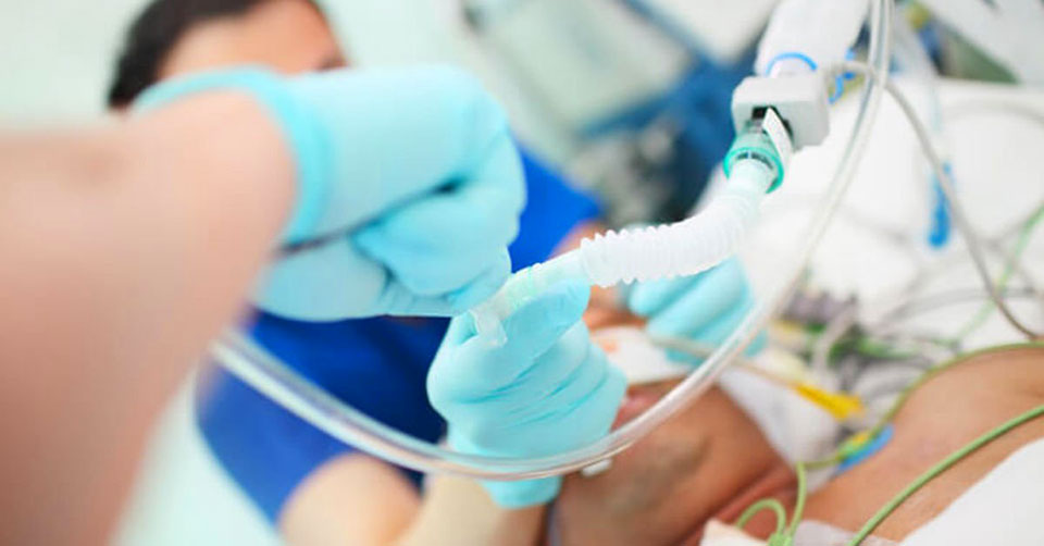 TS EN ISO 20789 Naprave, povezane z anestezijo in dihanjem - pasivni vlažilci