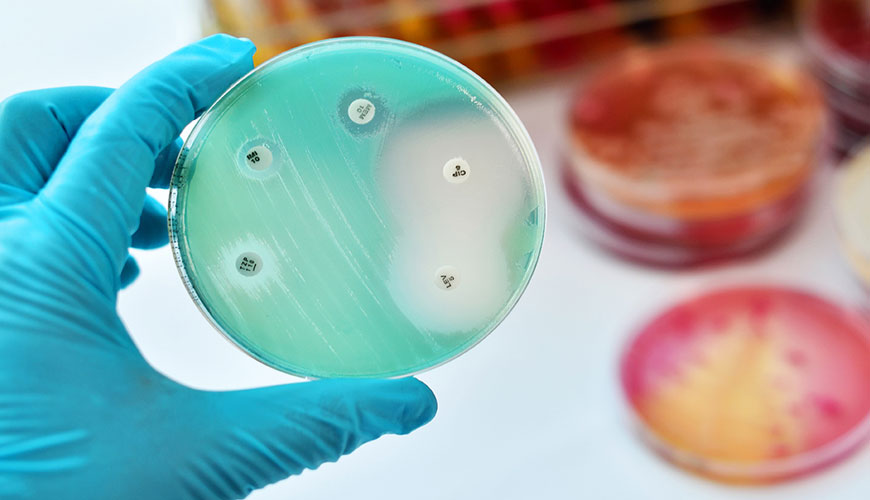 Phương pháp tiêu chuẩn USP 51 để kiểm tra hiệu quả kháng khuẩn